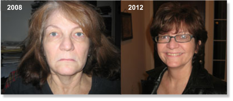 Before and After Sue Seward